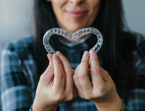 Love Your Aligners!